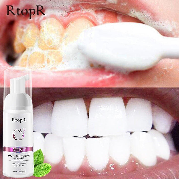 Tooth Whitening Mousse: Logra una Sonrisa Radiante Desde Casa