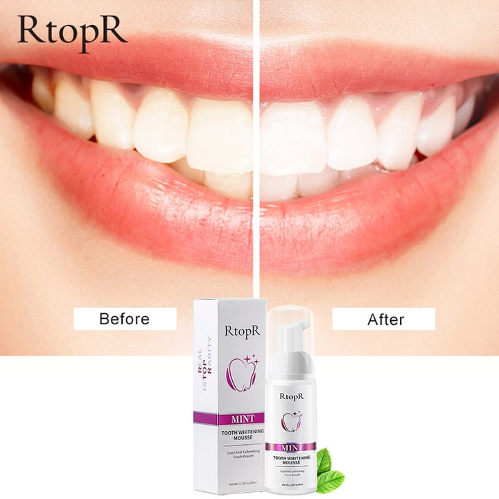 Tooth Whitening Mousse: Logra una Sonrisa Radiante Desde Casa